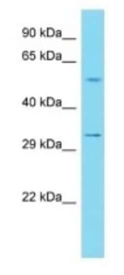 ILDR2 Rabbit anti-Human, Polyclonal, Novus Biologicals 100 &mu;g; Unconjugated:Antibodies,